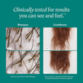 Nutrafol Shampoo and Conditioner for Thinning Hair, 8.1 Fl Oz